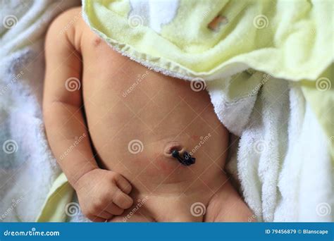 Newborn Baby Clothes Umbilical Cord at Rachel Molloy blog