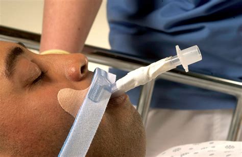 Stabilock. DALE Trach Collar. BUY Endo Trach Tube Holder 270