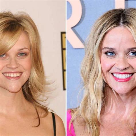 Reese Witherspoon Plastic Surgery Rumours | Bizrahmed