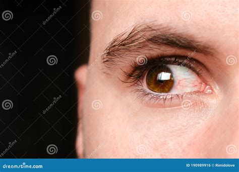 Close Up Mans Bloodshot or Red Eyes on a Black Background, Caused by Conjunctivitis, Allergy or ...