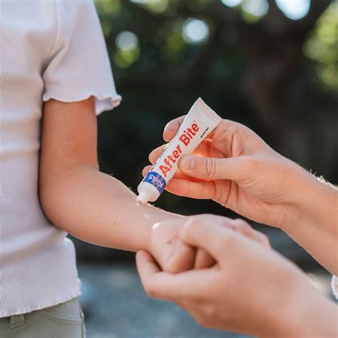 FSA Eligible After Bite Kids Itch Relieving Cream, 0.7 fl oz. | FSA Store