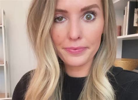 Eyelid Ptosis After Botox | Radiant Facial Rejuvenation