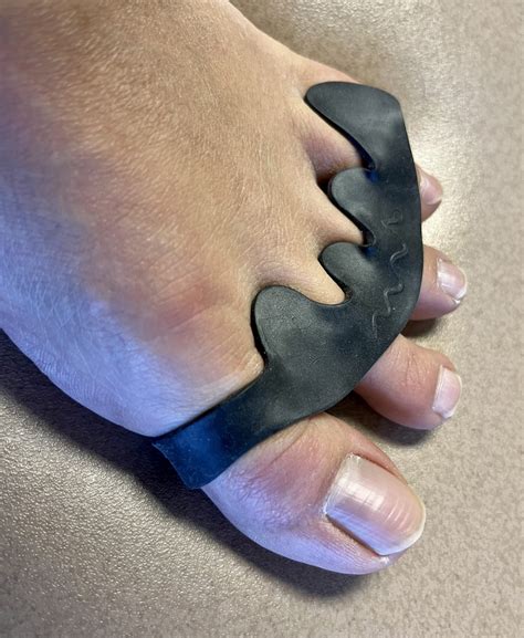 The Toe Spacer Review : Do Toe Spacers Work?