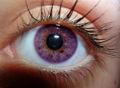 Natural Purple Iris Eye