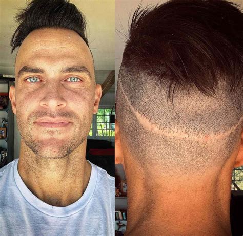 Cheyenne Jackson Reveals He's Had 5 Hair Transplant Surgeries