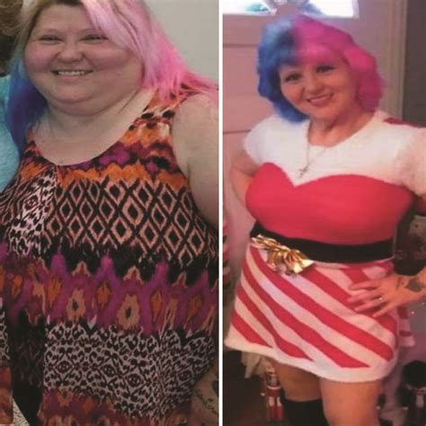 Bariatric Surgery in Cape Girardeau MO Southern Missouri (2024)