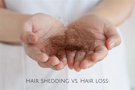 What is the difference between Hair Shedding and Hair Loss? - Kiwla