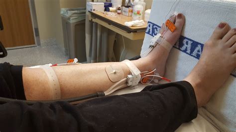 UW Medical Center Autonomic Testing – POTS: Finding Smiles in the Trials