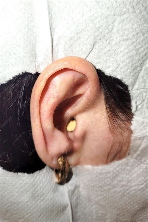 Premium Photo | Human ear with yellow gray inside clogged ear canal closeup