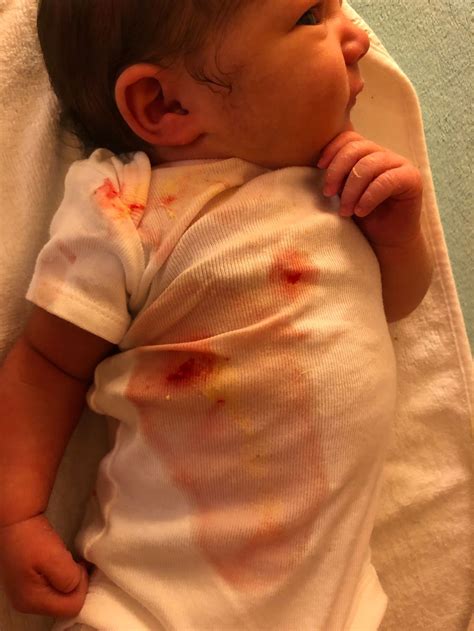 My Baby Just Spit Up Blood - Price TOP