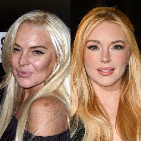 Lindsay Lohan Antes De Las Drogas Inacreditável O Antes E Depois Da