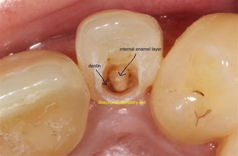 Dental photos, Teeth, Dental instruments