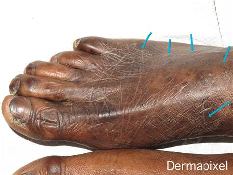 Dermapixel: agosto 2019