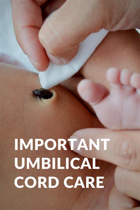 Umbilical Cord Care: No, Don't Pull It Off | Baby care tips, Newborn ...