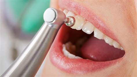 Everything You Need To Know About Deep Teeth Cleaning – FYVISM