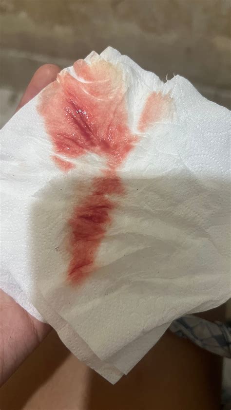 Ayuda, quiero saber si es sangrado de implantación | BabyCenter