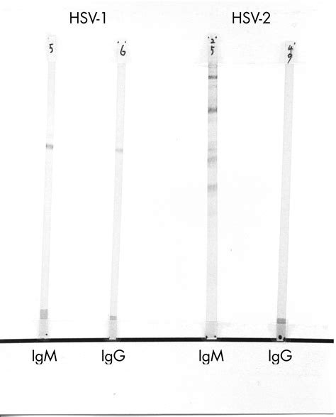 Is HSV serology useful for the management of first episode genital ...