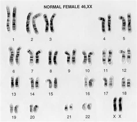 Is Xx Chromosome Female