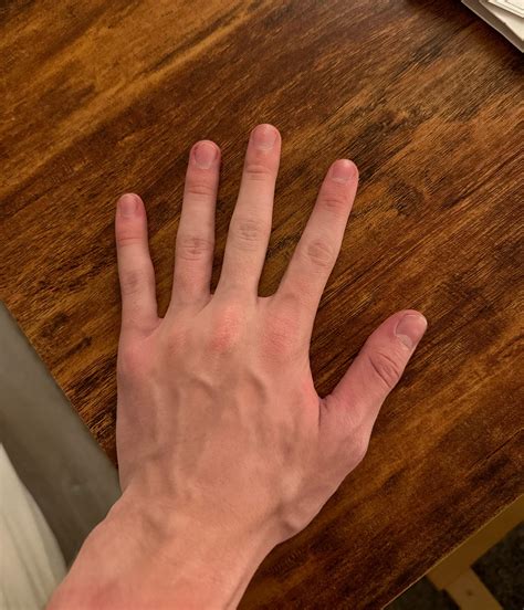 When my hands get hot, the veins pop out : r/hands