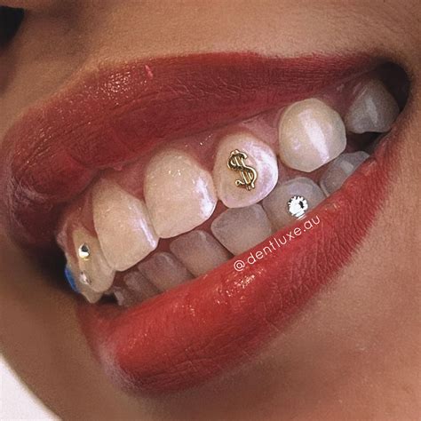 18k Gold Tooth Gem DOLLAR SIGN | Tooth gem, Gold teeth, White gold teeth