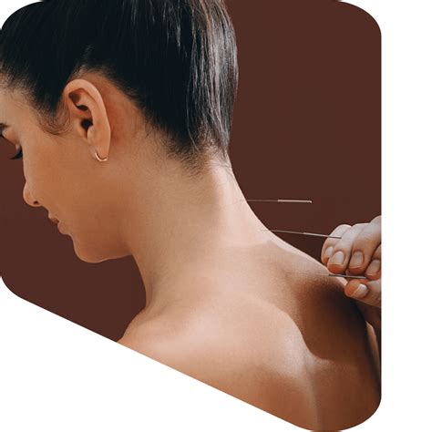 Dry Needling & Intramuscular Stimulation | Athlete’s Grid