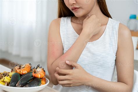 food allergies. women have reactions itching and redness after eating ...