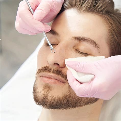 The Best Way for Blackhead Removal That Dermatologists Actually Approv ...