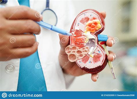 Glomerular Filtration Kidney Disease at Bryan Riggs blog