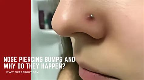 Why Does My Nose Piercing Have a Bump? (And How to Get Rid of It ...