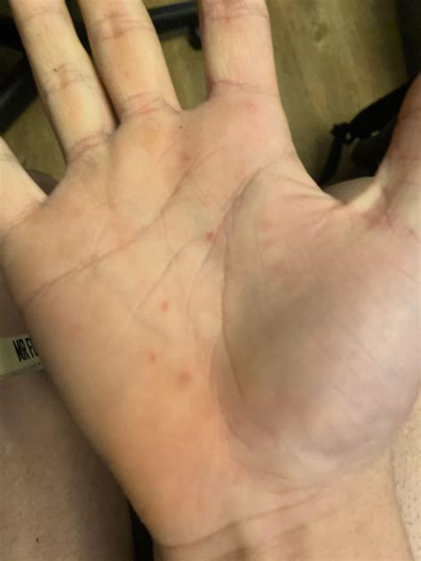 I have these red spots growing on my body and they hurt when I irritate them they’re mainly on ...