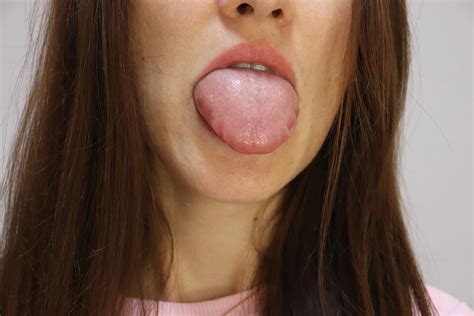 Angioedema Unveiled: Understanding Causes, Symptoms, and Effective Treatments - WellnessRead.com