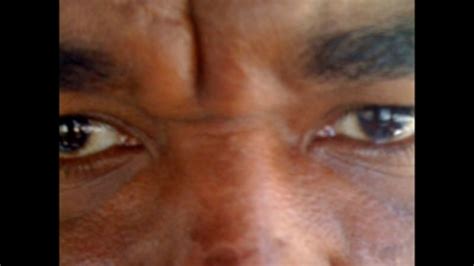 TMZ's Summer Sunburn Snapshots Contest