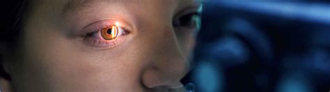 Eye Cancer Treatment and Diagnosis in Abu Dhabi | Eye Tumor