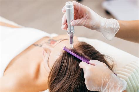 Microneedling Hair – AESTHETIC CARE BEAUTY CLINIC