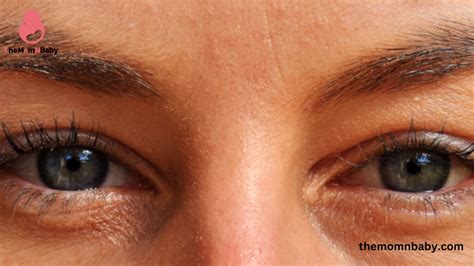 Sunken Eyes In Pregnancy : Causes, Symptom, Effects, Treatment