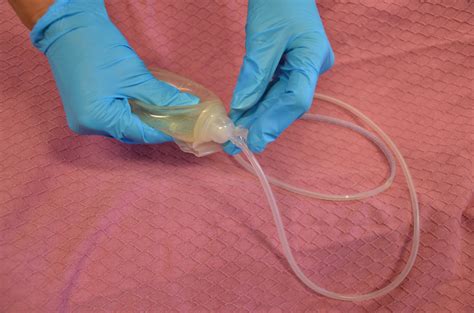 T Tube Drain Removal