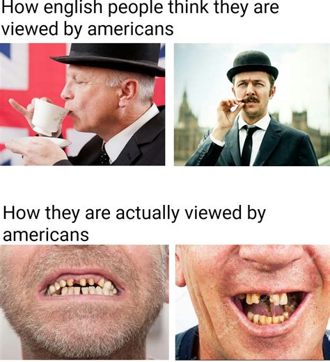95 English People Teeth Meme