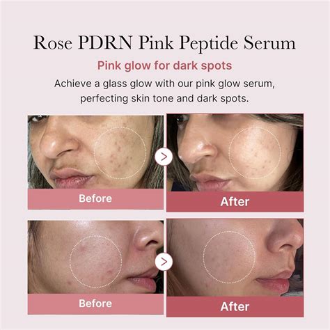 Medicube PDRN Pink Peptide Serum, Pink glow serum, Peptide, Niacinamide ...