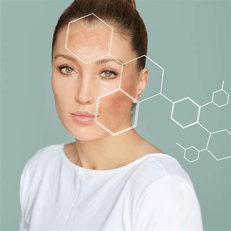 What Is the Best Skin Lightening Treatment in Maryland? - Estar MedSpa ...