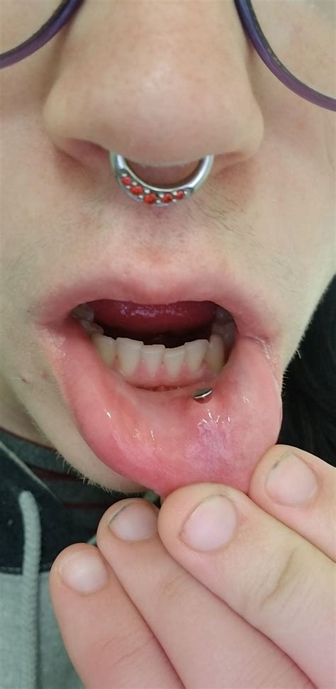 Inside Bottom Lip Piercing