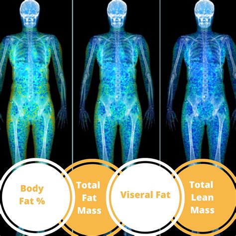DEXA Body Composition Scan - Health Focus Clinic