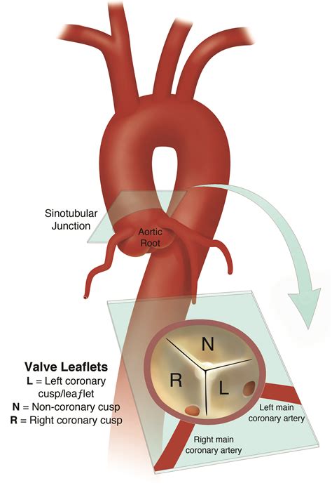 Aortic Root