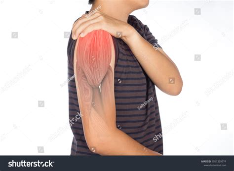 Upper Arm Muscles