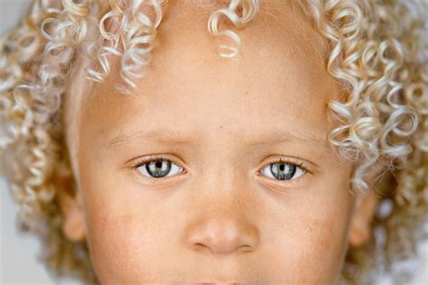 Black Babies With Blue Eyes And Blonde Hair