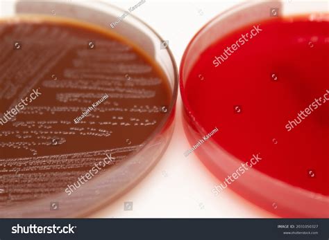 Chocolate Agar Haemophilus at Robert Printz blog