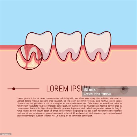 Vetores de Estrutura Da Cruzseção Da Disposição Dentro Do Vetor Da ...