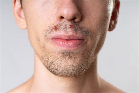 Crystal Meth: Physical Dangers | Zinnia Health