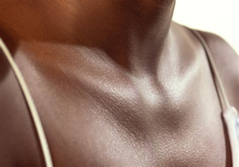 How Common Skin Conditions Can Look Different on Skin of Color