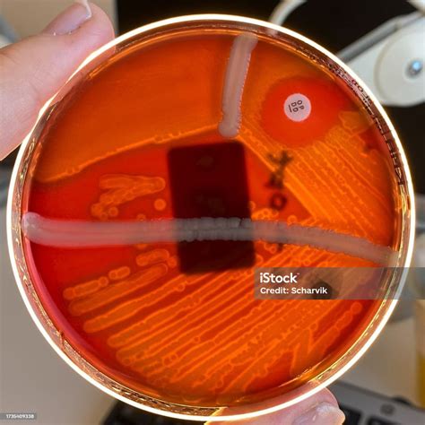 Streptococcus Pneumonia Grown With Optochin Disk Stock Photo - Download ...
