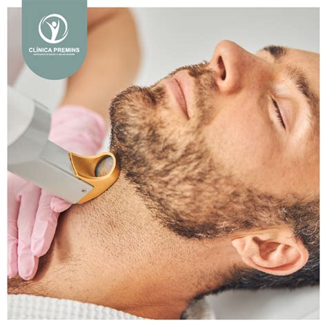 Depilación láser barba con cuello hombre - Nueva Clínica Premins